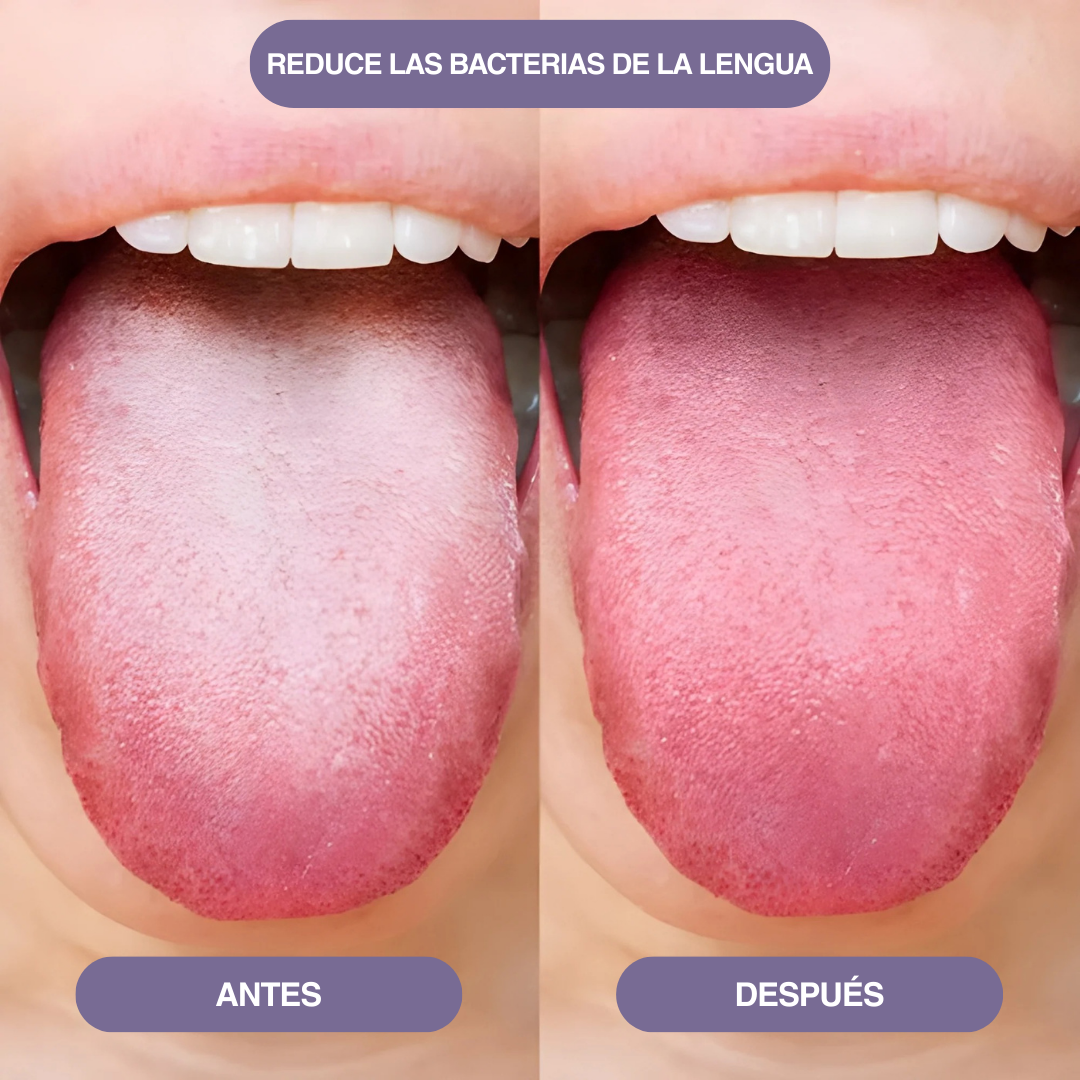 Spray Oral Probiótico