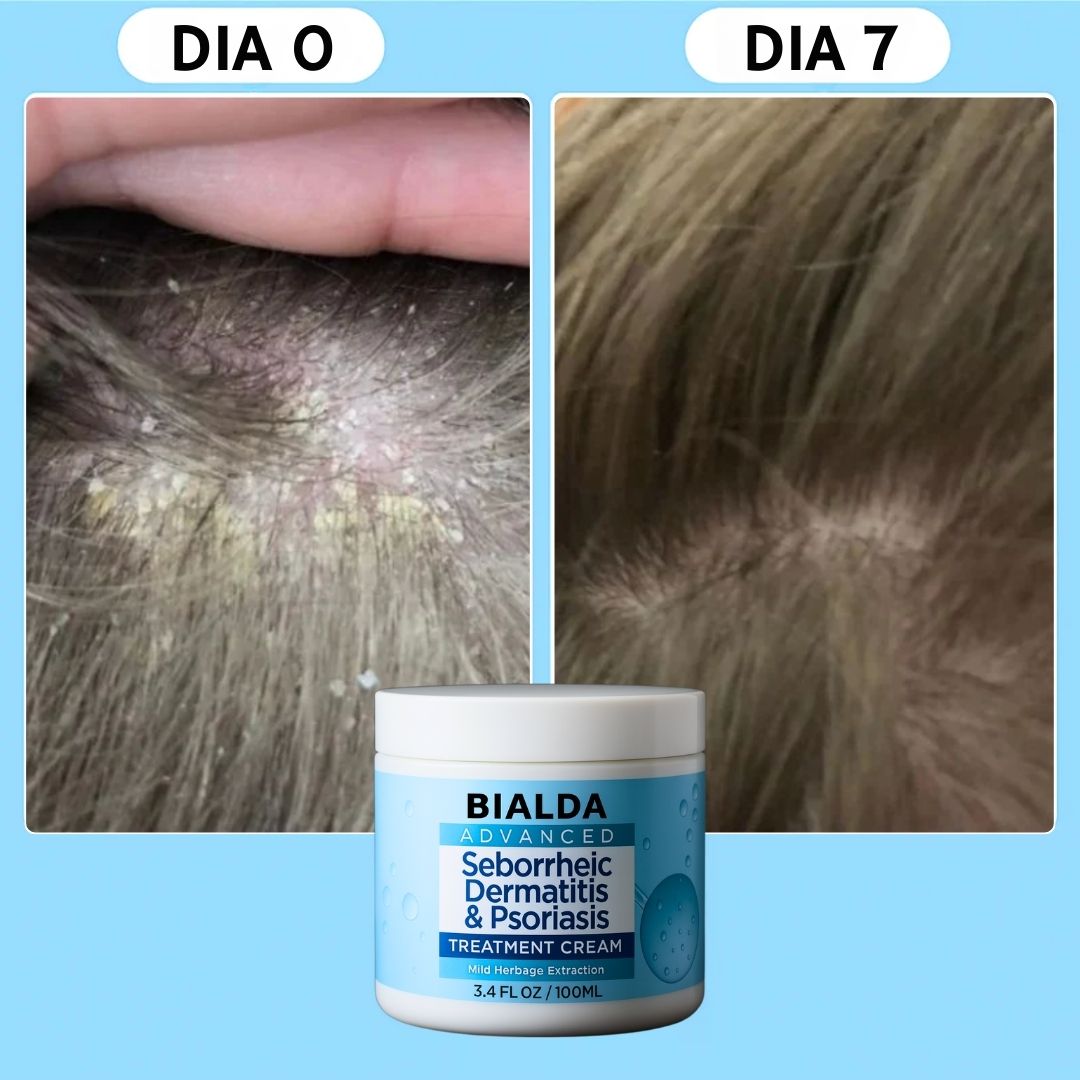 Bálsamo calmante para el cuero cabelludo