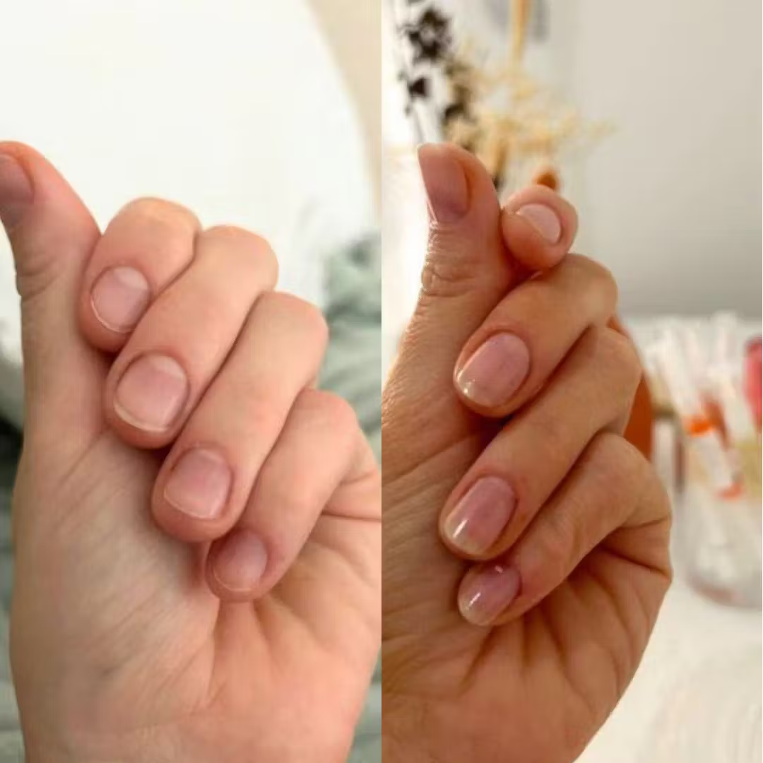 NailRenew Prime Nail Serum with DualPeptide Formula™